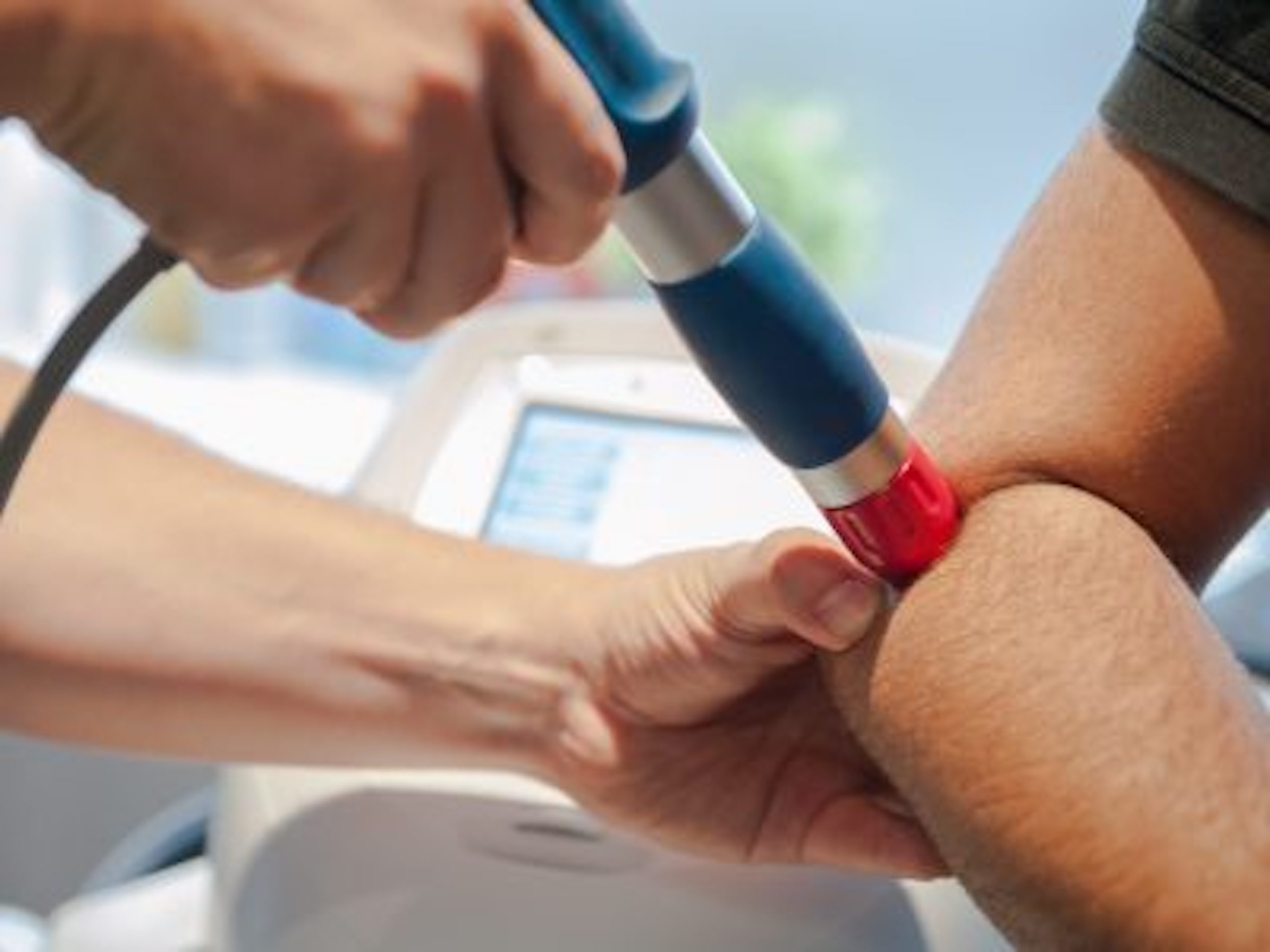 Ondas de Choque. Clínica Kine de fisioterapia y osteopatía en Lleida.