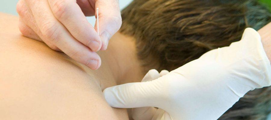 Punción seca | Centre Kine